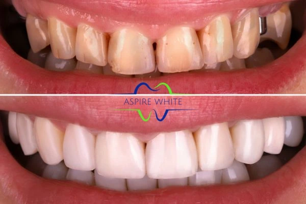 Before And After Results Chelmsford