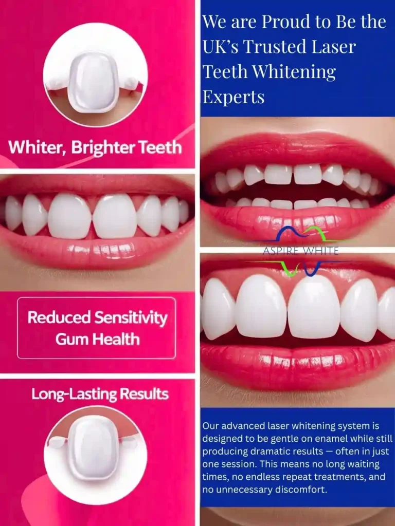 We are Proud to Be the UK’s Trusted Laser Teeth Whitening Experts Chelmsford